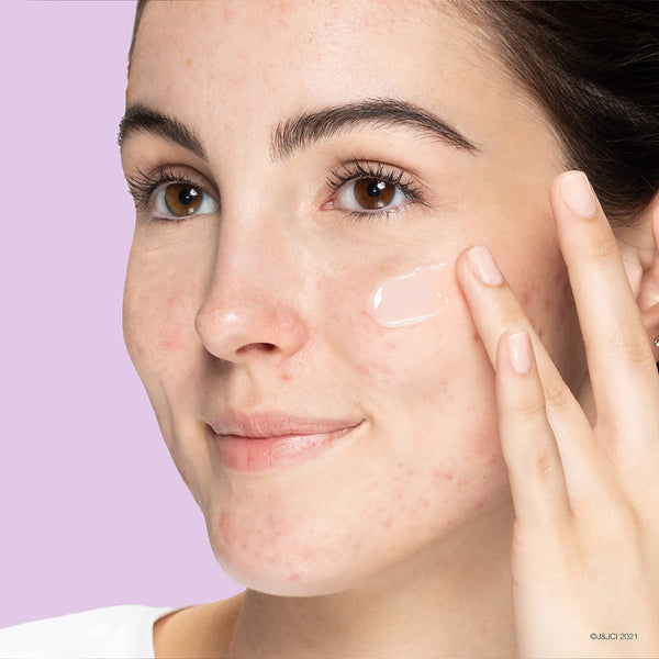 Clean & Clear Aloe Vera Calming Gel Acne Facial Moisturizer for Acne-Prone & Sensitive Skin, Oil-Free Daily Moisturizing Gel, 4.9 Oz