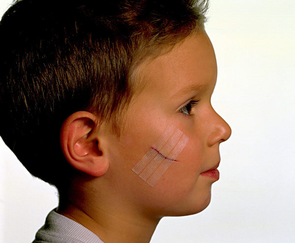 Nexcare Steri-Strip Wound Closure, Secures and closes small cuts and wounds, 1/4 Inch x 4 Inch, 30 Count